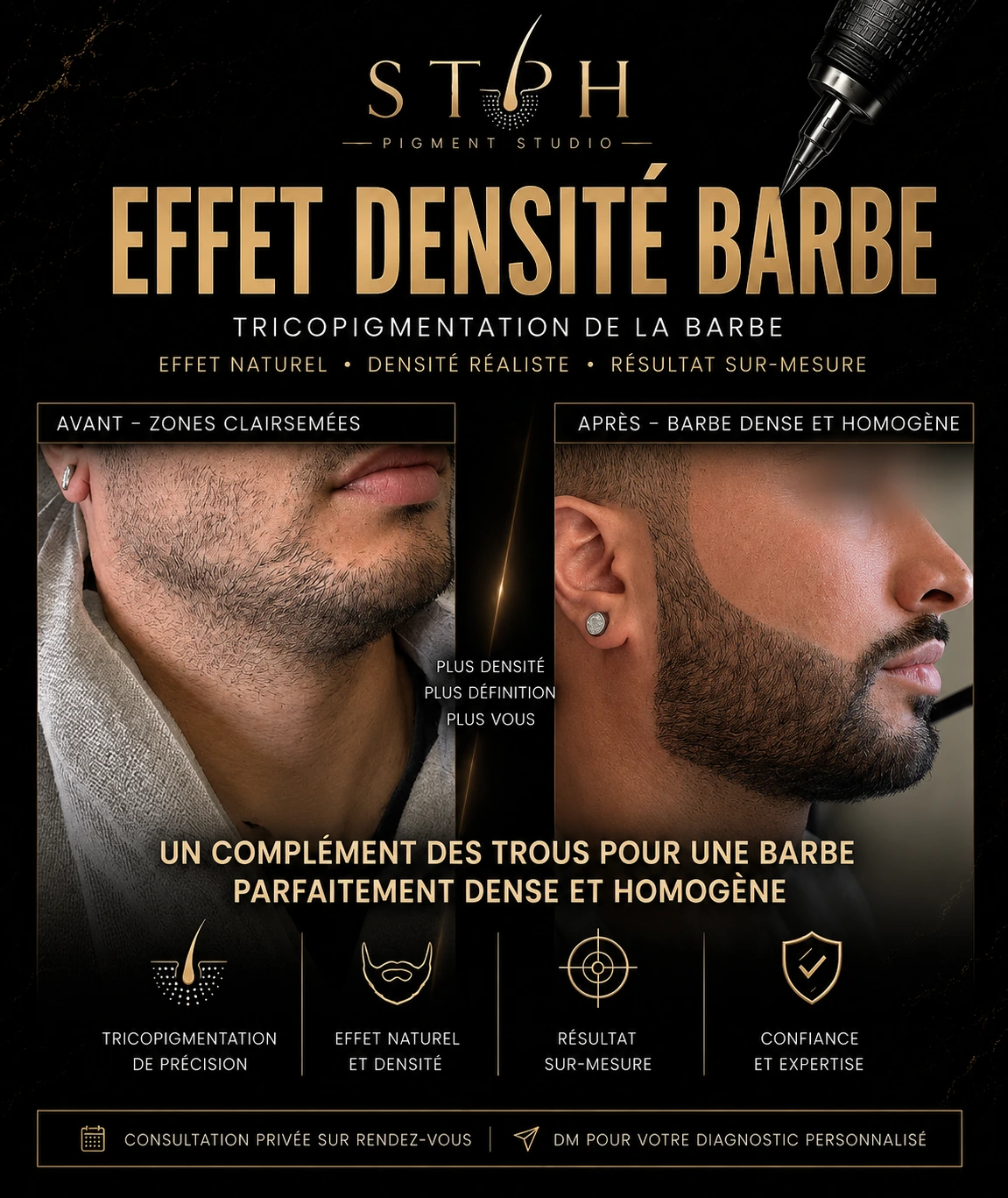 Visuel STPH effet densité barbe : zones clairsemées avant et apparence plus homogène après, gros plan de la joue et de la mâchoire
