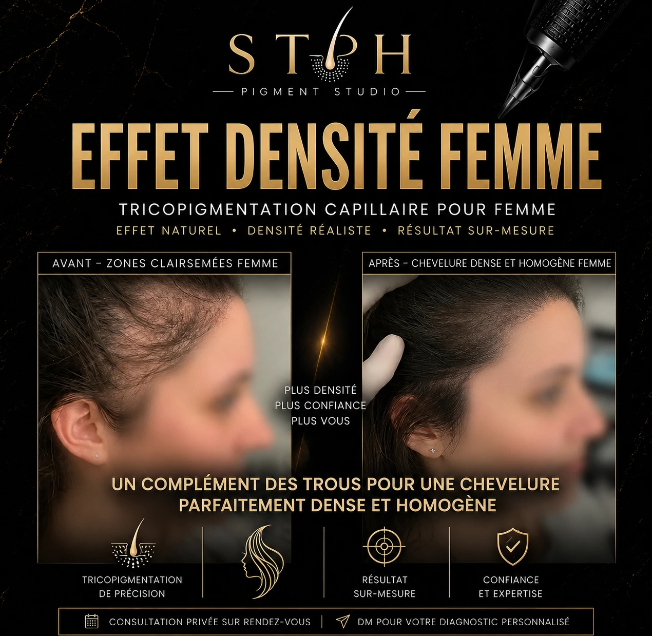 Visuel STPH effet densité femme : comparaison avant et après sur une zone temporale