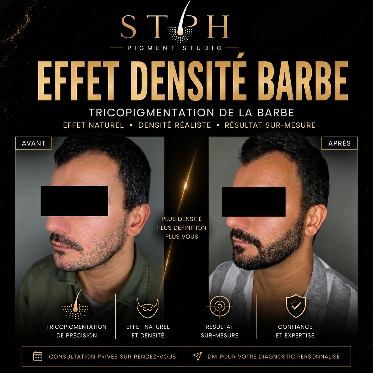 Visuel STPH effet densité barbe : comparaison avant et après de la barbe, vue de trois quarts