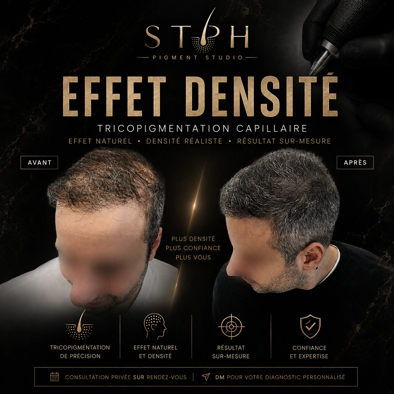 Visuel STPH effet densité : comparaison avant et après de la chevelure, vue de dessus et de trois quarts