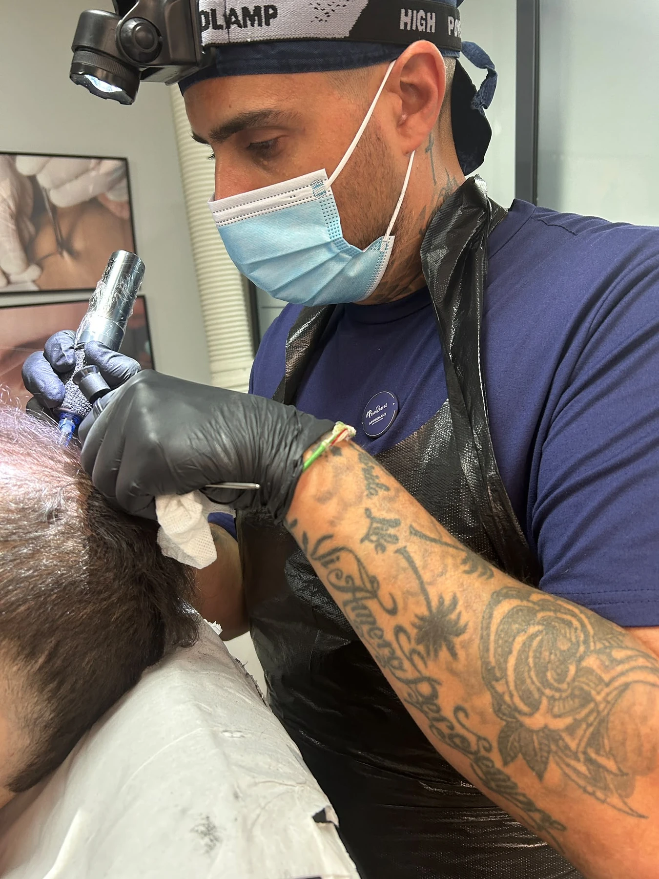 Stéphane, praticien en tricopigmentation, travaillant avec précision sur le cuir chevelu, avec masque et gants